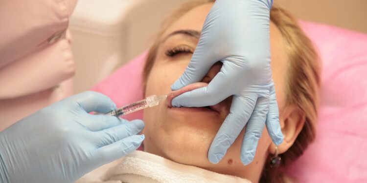 Get Luscious Lips with Dr. Led’s Expert Lip Fillers in Derby