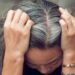 Gray Hair Reversal: Everything You Need to Know 
