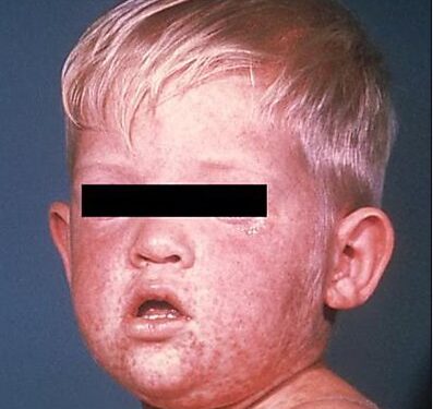 Red America Would Suffer Under RFK Jr.